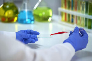 pgx-testing-and-its-importance-in-preventive-healthcare